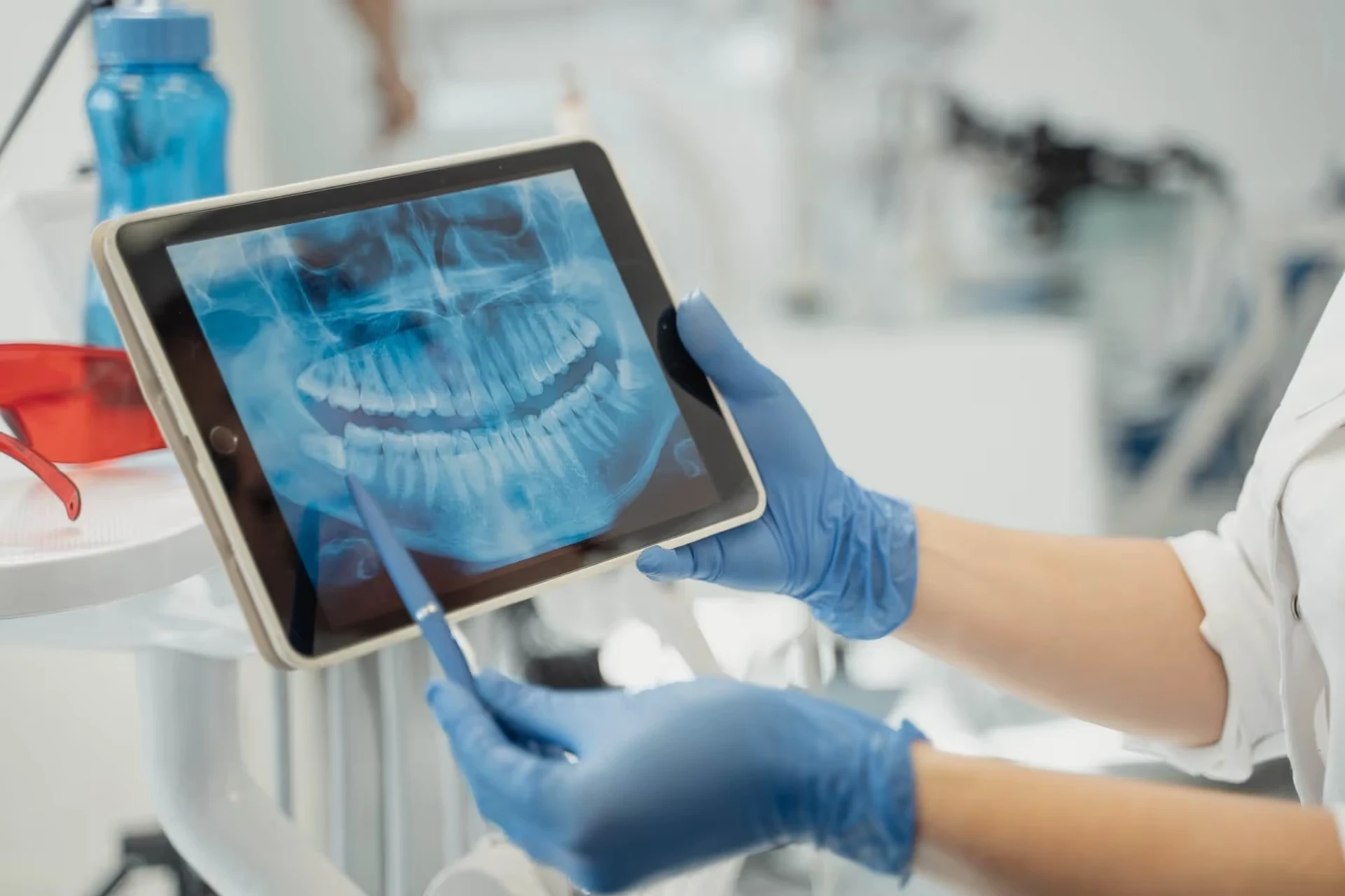 Dental röntgen görüntüsünün değerlendirilmesi